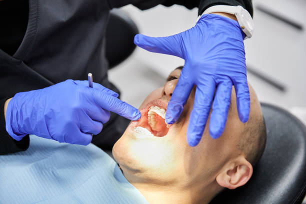 Best Emergency Treatment for Toothache in Clarksburg, MD